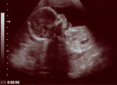 Baby Three Profile